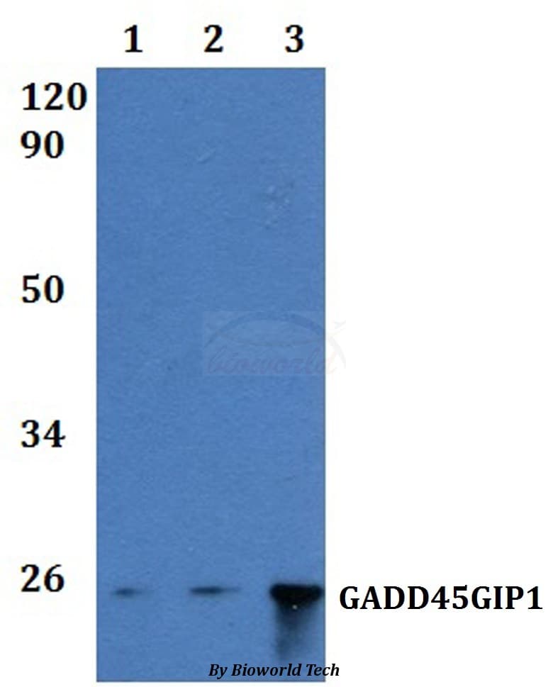 GADD45GIP1 / CRIF1 Antibody