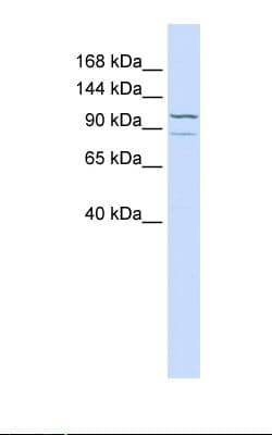 ADCY6 / Adenylate Cyclase 6 Antibody (aa794-843, HRP)