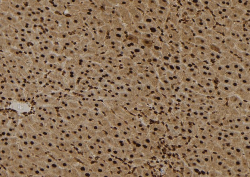 EPS8L3 Antibody