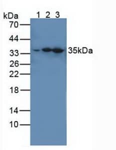 IRAK4 / IRAK-4 Antibody (aa189-427)