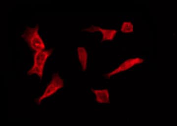 OR1B1 Antibody