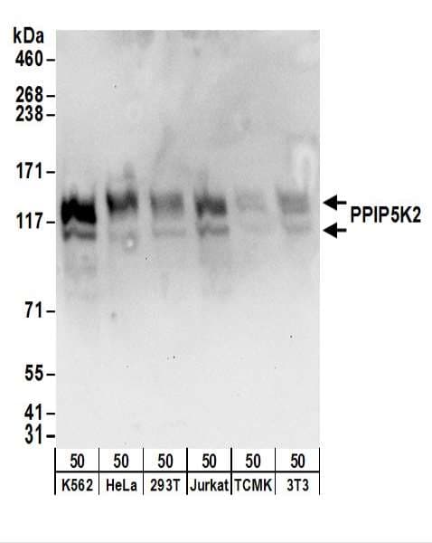 Polyclonal Rabbit anti-Human PPIP5K2 / HISPPD1 Antibody (aa925-975, WB)