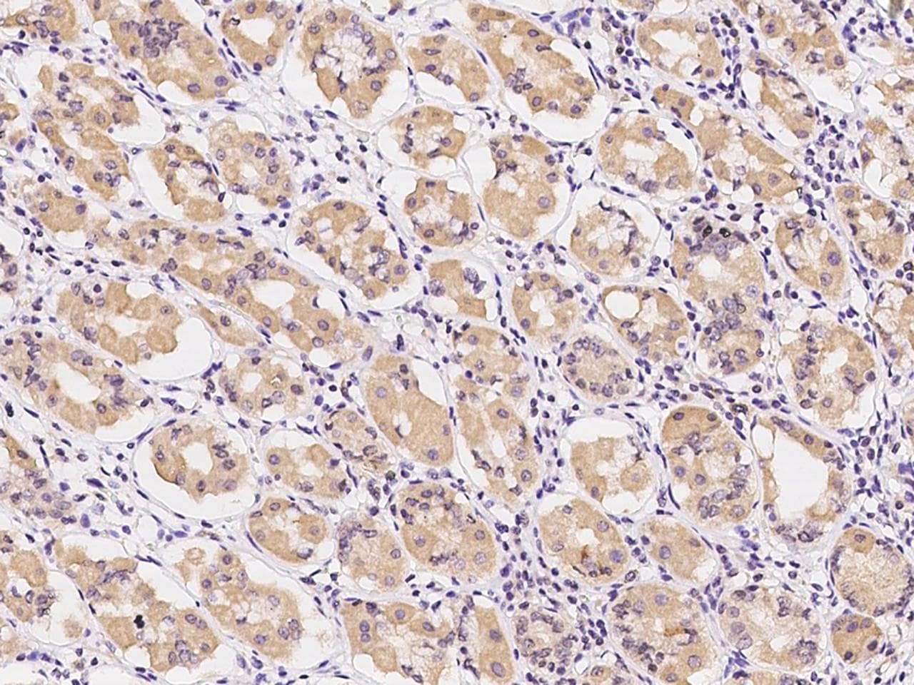 Polyclonal Rabbit anti-Human OFD1 Antibody (IHC)