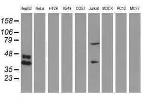 Monoclonal Mouse anti-Human HP / Haptoglobin Antibody (clone OTI2B11, WB)