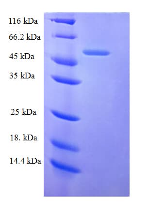 Human TMEM25 Protein (Recombinant His-SUMO)