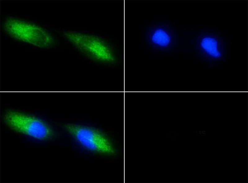 BIRC5 / Survivin Antibody (clone 8E2)