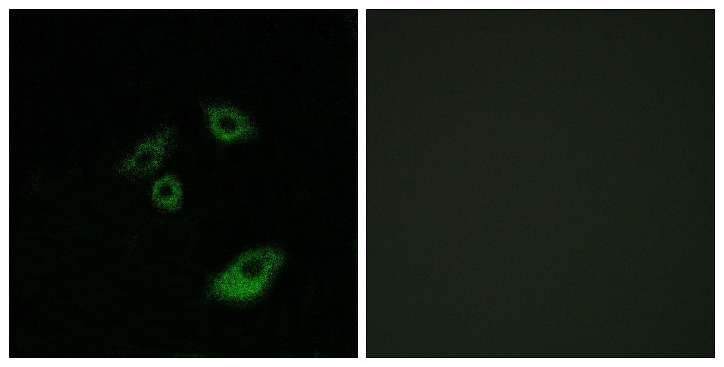 Polyclonal Rabbit anti-Human BCL2 / Bcl-2 Antibody (phospho-Thr56, IHC, IF, WB)