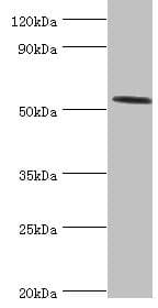 HYAL2 Antibody (aa367-473)