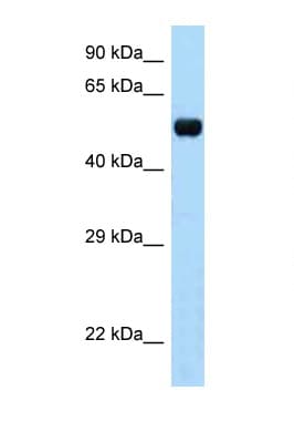 TAPBPL / TAPBPR Antibody (aa61-110)