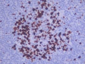 MKI67 / Ki67 Antibody (Internal)