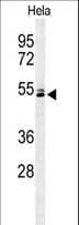 KRT78 / Keratin 78 Antibody (aa176-203)