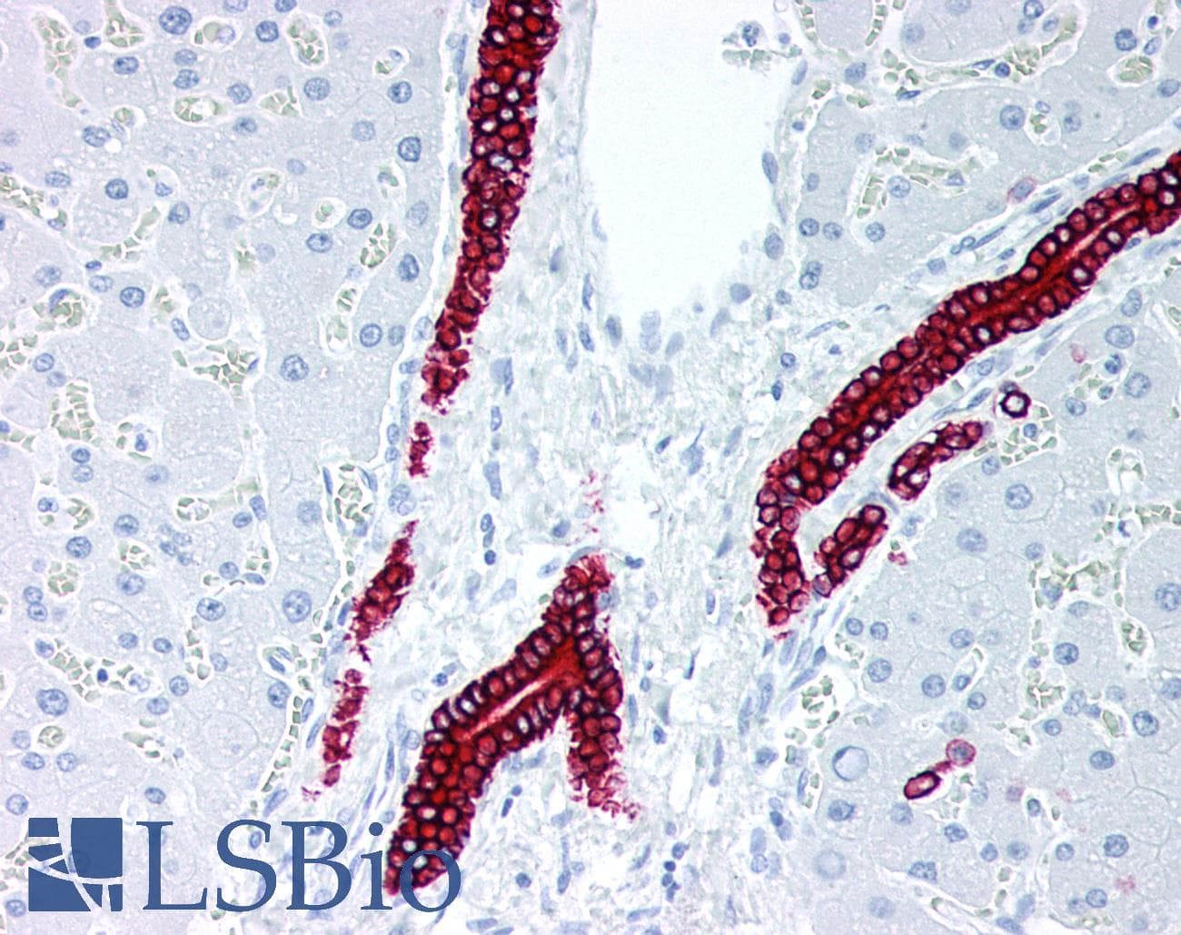 IHC-plus™ Monoclonal Mouse anti-Human KRT7 / CK7 / Cytokeratin 7 Antibody (clone ABT-CK7, IHC, WB)