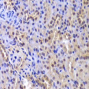 MKI67 / Ki67 Antibody