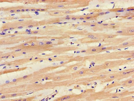 Polyclonal Rabbit anti-Human SLC25A6 / ANT3 Antibody (IHC, WB)