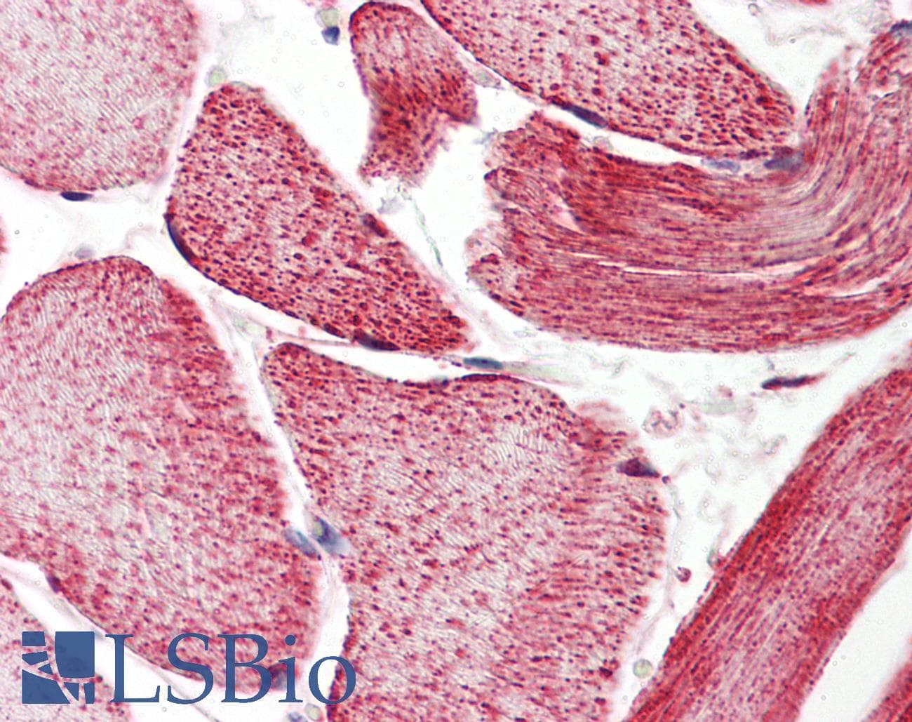 IHC-plus™ ECI2 / PECI Antibody (aa73-122)