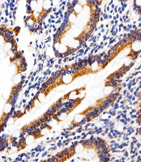 SHB Antibody (Tyr268)