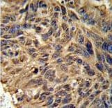 Polyclonal Rabbit anti-Human FBXL2 Antibody (aa366-395, IHC, WB)