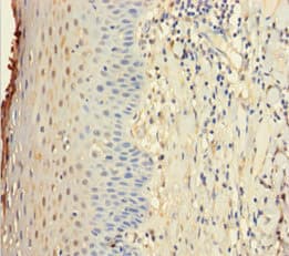 Polyclonal Rabbit anti-Human IL22RA1 / IL22R Antibody (aa250-573)