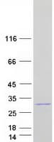 Human STARD4 Protein (Recombinant Myc-DDK (Flag))
