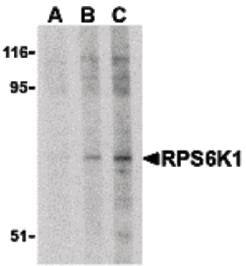 IHC-plus™ Polyclonal Rabbit anti-Human RPS6KA1 / RSK1 Antibody (IHC, IF, WB)