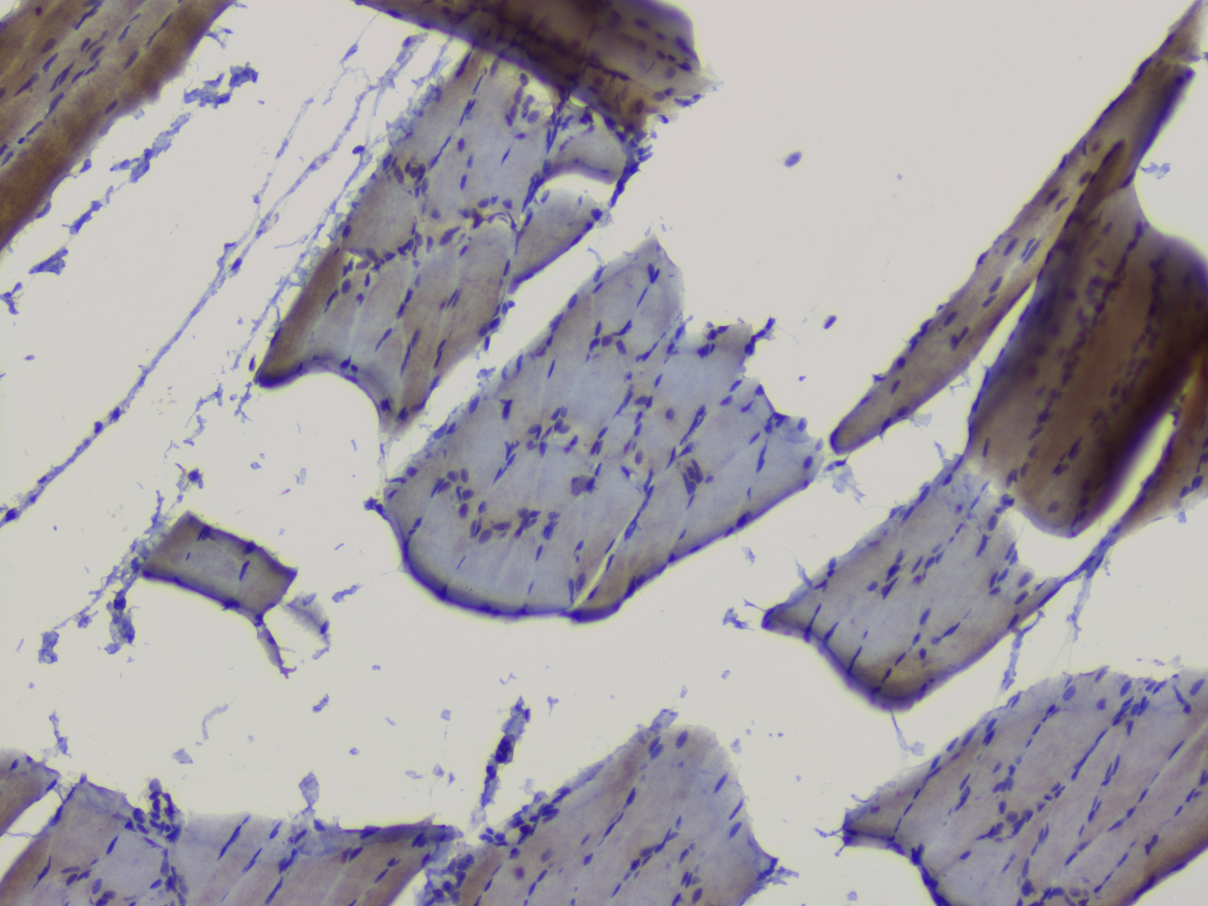 NRF1 / NRF-1 Antibody