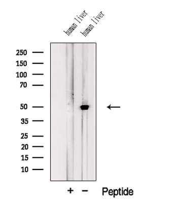 KDM8 / JMJD5 / FLJ13798 Antibody