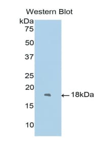 FOXC1 Antibody (aa62-186)