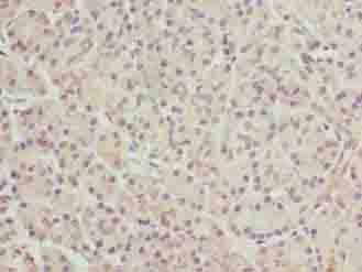 Polyclonal Rabbit anti-Human FAR2 Antibody (IHC)