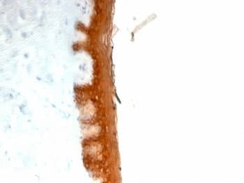 KRT10 / CK10 / Cytokeratin 10 Antibody (clone KRT10/844)