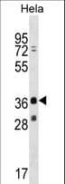 MAGEB16 Antibody (aa229-258)