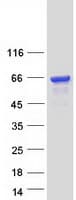 Human EPS8L3 Protein (Recombinant Myc-DDK (Flag))