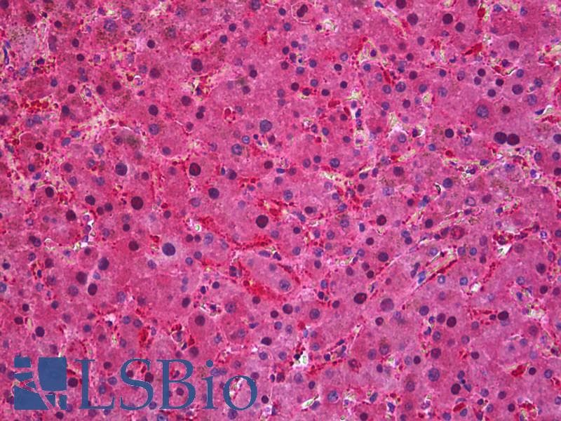 IHC-plus™ Polyclonal Goat anti-Human SEC61A1 / SEC61 Antibody (aa463-476, IHC, WB)