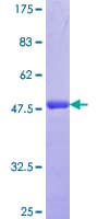 Human SDC2 / Syndecan 2 Protein (Recombinant GST, N-terminus)