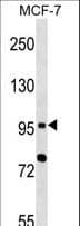 TLR6 Antibody (aa1-30)