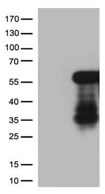 HOXA2 Antibody (aa57-319, clone OTI6A6)