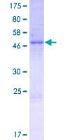 Human PPP1R42 / LRRC67 Protein (Recombinant GST)