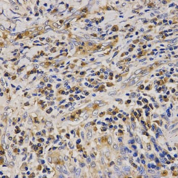 LL37 / Cathelicidin Antibody