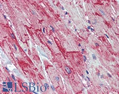 IHC-plus™ SLC8A1 / NCX1 Antibody