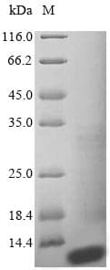 Human BCMP84 / S100A14 Protein (Recombinant 6His, N-terminus)