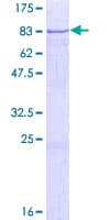 Human CCDC83 Protein (Recombinant GST)