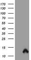 Monoclonal Mouse anti-Human S100P Antibody (clone OTI1F1, WB)