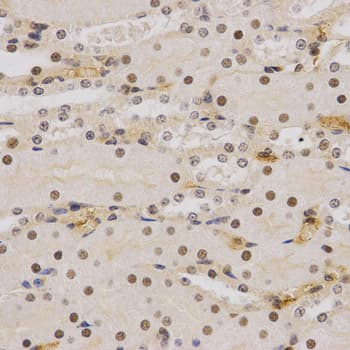 SMARCE1 / BAF57 Antibody