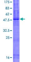 Human TMEM8B / NGX6 Protein (Recombinant GST)