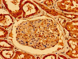 Polyclonal Rabbit anti-Human NOTCH2 Antibody (IHC)