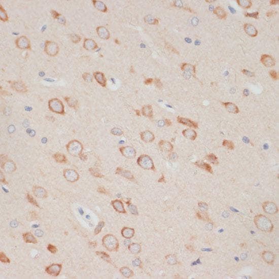 AXIN2 / Axin 2 Antibody