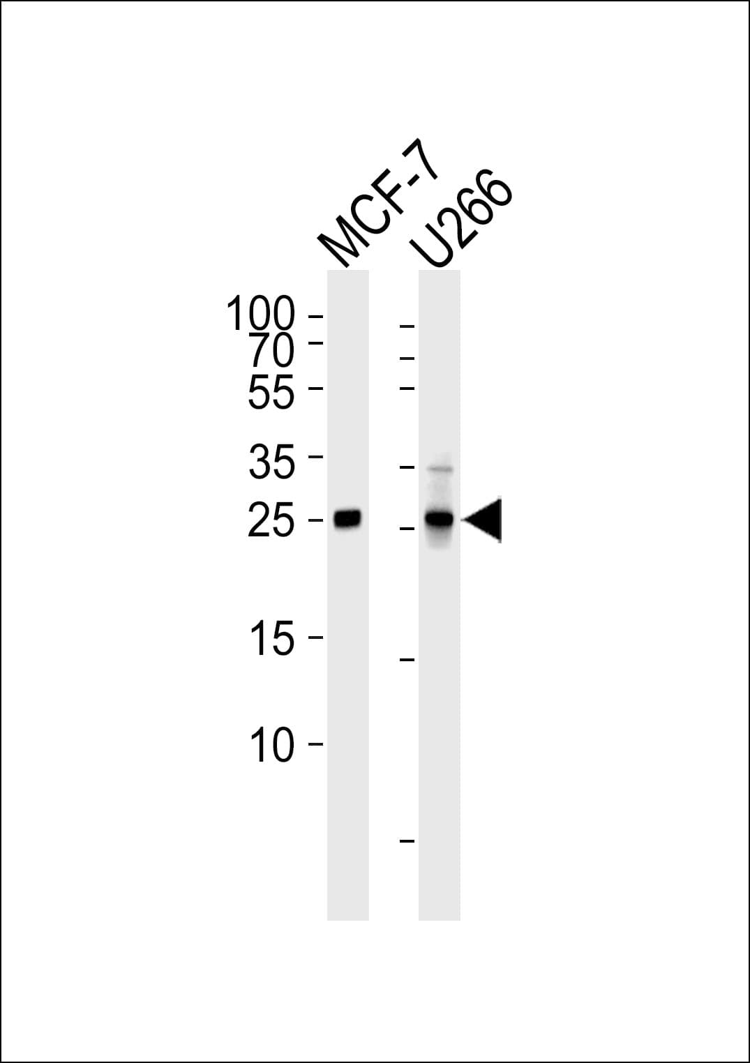 CDKN1B / p27 Kip1 Antibody (clone 1373CT407.103.103)
