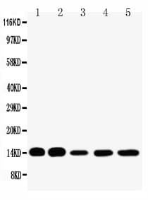 FABP1 / L-FABP Antibody (aa30-46)
