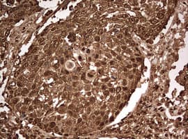 Monoclonal Mouse anti-Human GAPDH Antibody (clone OTI2F9, IHC, WB)