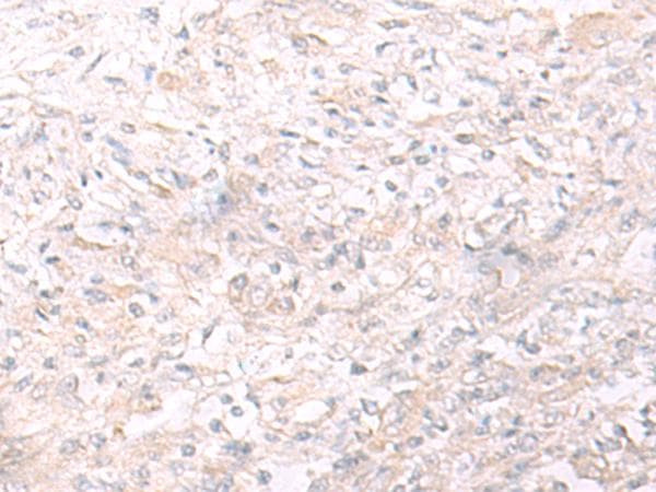 IL26 Antibody