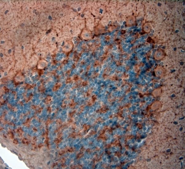 GAD 65+67 Antibody (aa530-600)